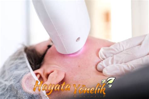 Lazer Epilasyon Cilt Tipi Farklılıkları Lazer Epilasyon Cilt Tipi Farklılıkları