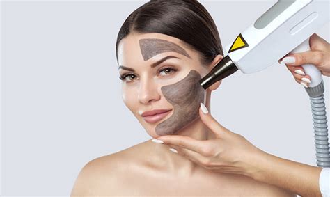 Lazerle Karbon Peeling Yaptıranların yorumları Lazerle Karbon Peeling Yaptıranların yorumları