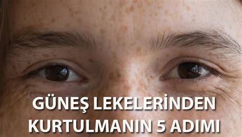 Microblading Silinme Sebepleri Microblading Silinme Sebepleri