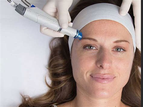 Hydrafacial Ne İşe Yarar Hydrafacial Ne İşe Yarar