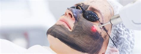Karbon Peeling Ne İşe Yarar Karbon Peeling Ne İşe Yarar
